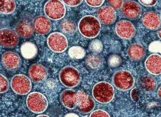 Mitä tiedämme sairaudesta mpox news-15082024-182335